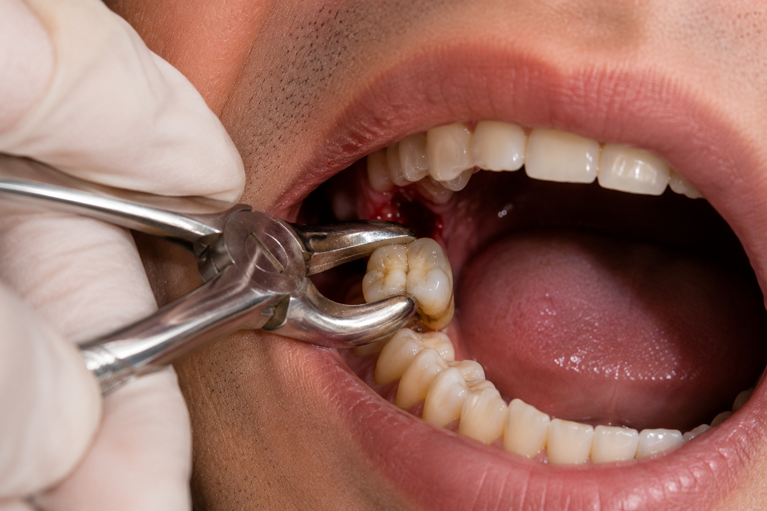Painless Dental Procedures