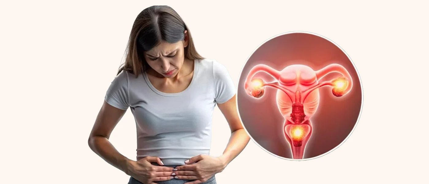 PCOS and hormonal disorders