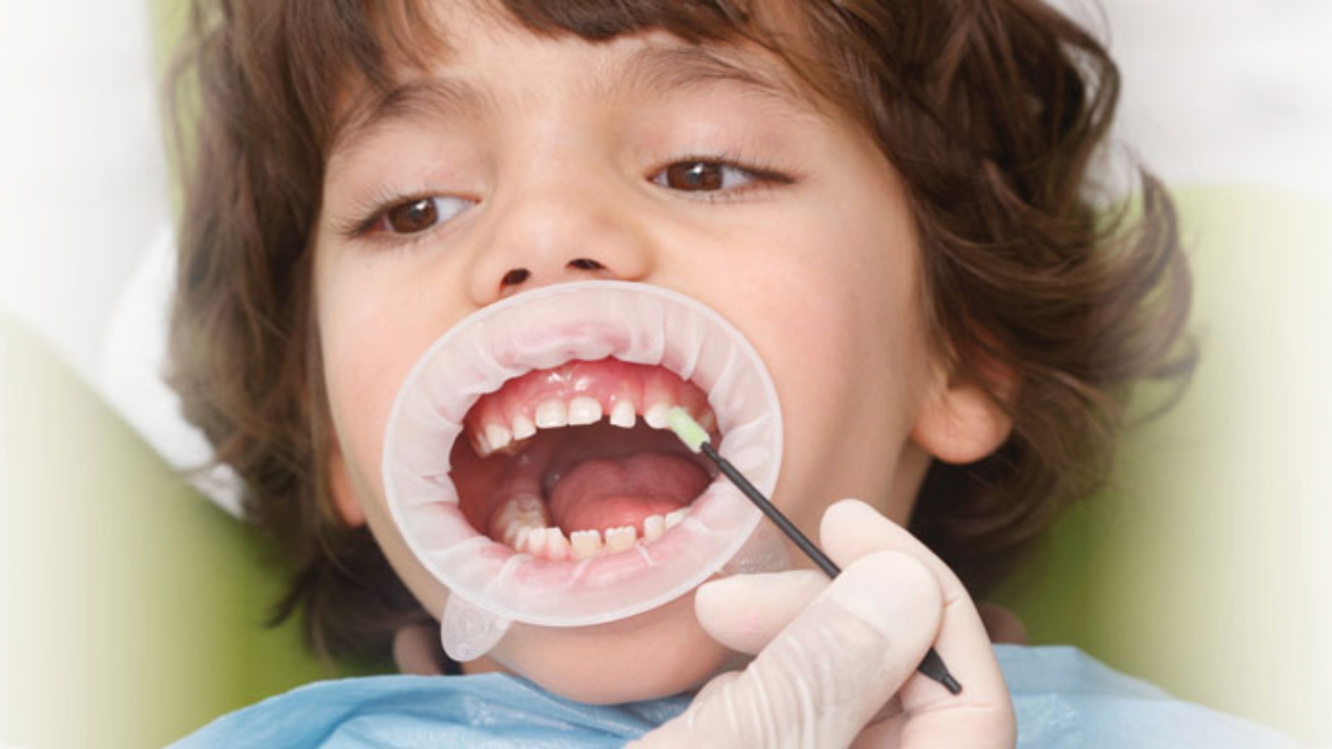 Preventive dental care